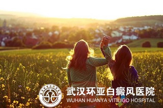 女性治疗白癜风有哪些注意事项
