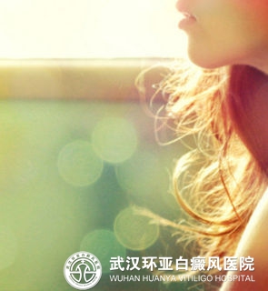 女性患上白癜风该怎么办