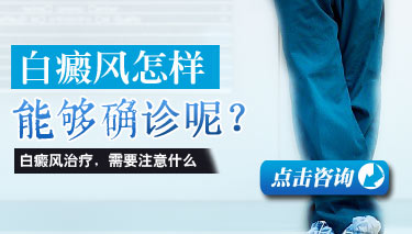 诊断白癜风有哪些方法呢