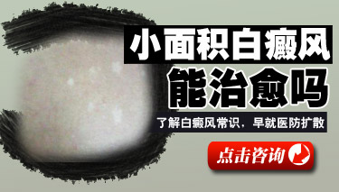 人ļҽԺưϺ