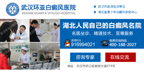 武汉市治疗白癜风的医院在哪