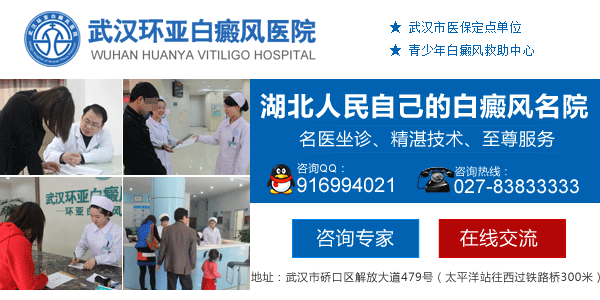 武汉哪个医生能看好白癜风