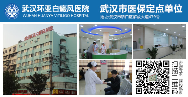 武汉哪几个医院治白癜风好