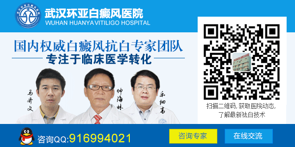 武汉哪个医院治疗小儿白癜风好