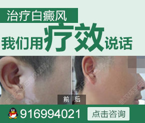 武汉哪有白癜风医院