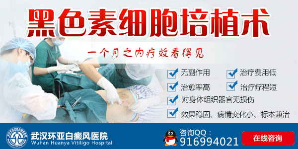 武汉白癜风哪家治疗较好