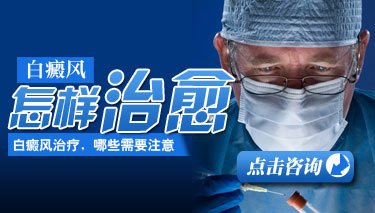 武汉身上白癜风白斑怎么治?